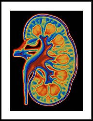 kidney image